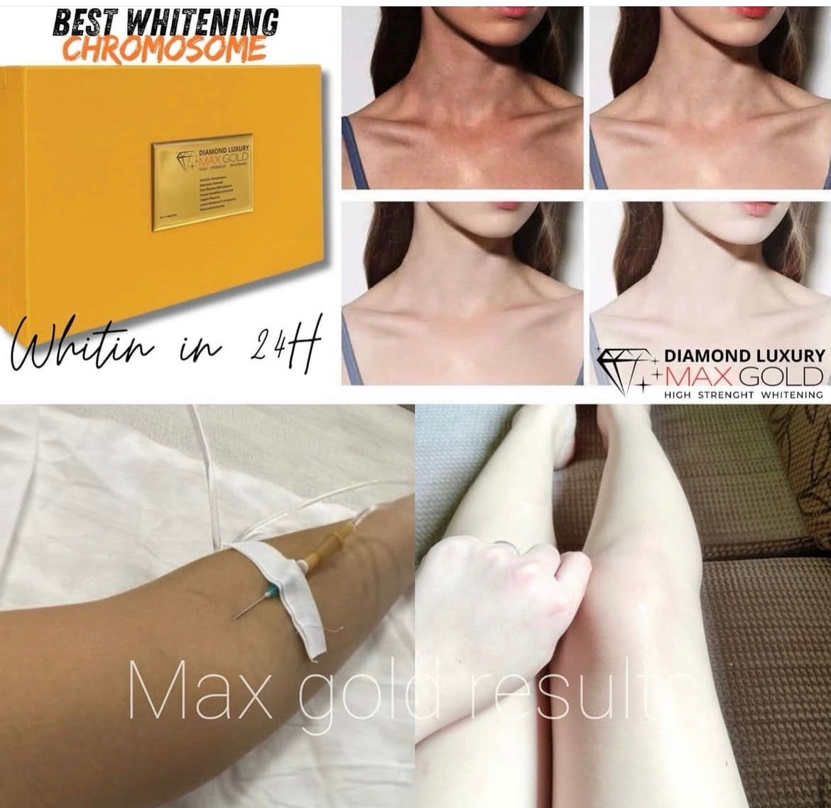 DIAMOND LUXURY MAX GOLD (inj. Permanente)